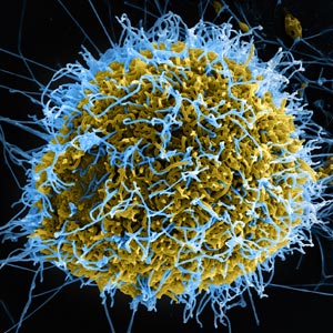 Ebola NIH NIAID Creative Commons
